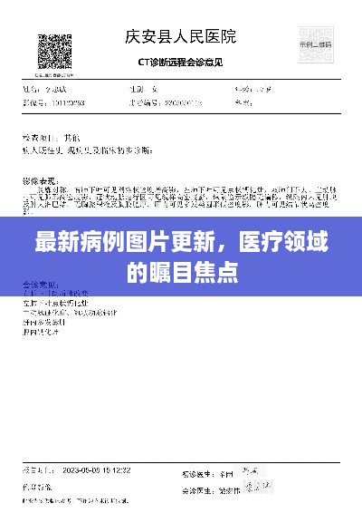 最新病例图片更新，医疗领域的瞩目焦点
